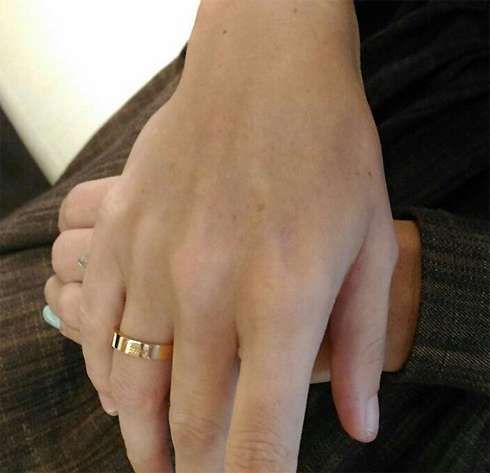 Дана сняла обручальное кольцо с пальца