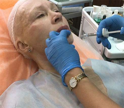 Татьяне Васильевой сделали уколы красоты Татьяне Васильевой сделали уколы красоты