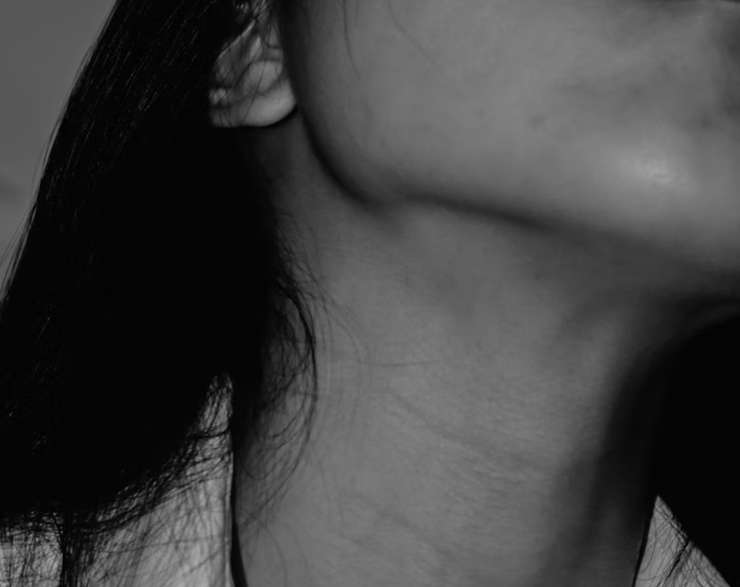 А по шее: уход за этой частью тела в холодное время года, 5 неочевидных правил А по шее: уход за этой частью тела в холодное время года, 5 неочевидных правил