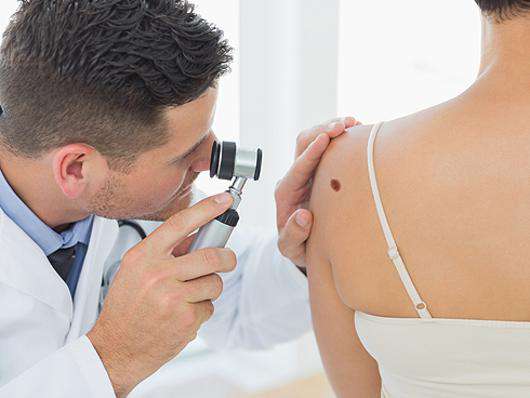 Как отличить родинку от меланомы? Фото: Lori.ru.