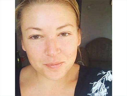 Ирина Дубцова выложила видео, на котором видно, что у нее ссадина на носу и опухшее лицо. Фото: Instagram.com/dubtsova_official.