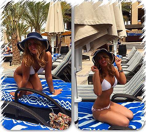 В Дубае Анна Шульгина переборщила с принятием солнечных ванн... Фото: Instagram.com/anna_shulgina.