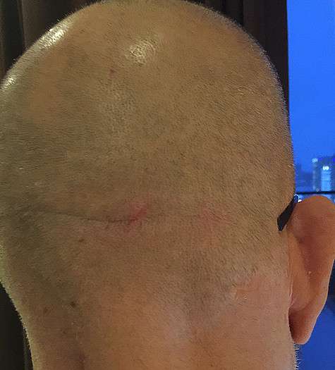 На следующий день после инцидента в отеле Шуфутинский почувствовал головокружение и головные боли. Фото: материалы пресс-служб.