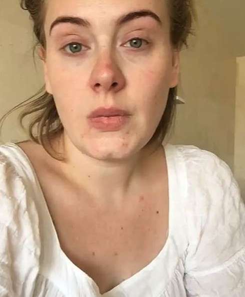 Адель лично сообщила поклонникам о своей простуде 