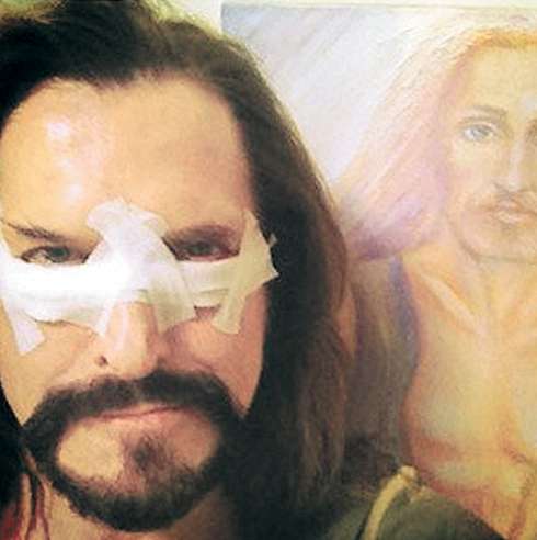 Никита Джигурда сделал пластическую операцию