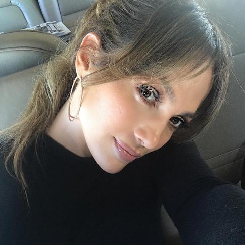 Дженнифер Лопес напугала синяком под глазом