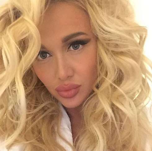 Большие губы , по мнению поклонников, Вике не идут