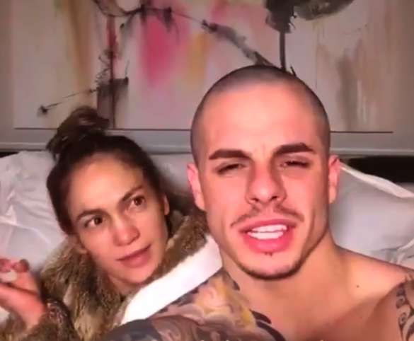 Достоянием общественности стали темные круги под глазами поп-звезды, опухшие веки и красный нос