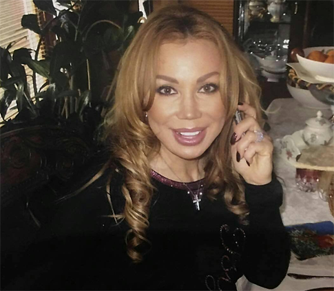 Машу Распутину не узнают после пластики?