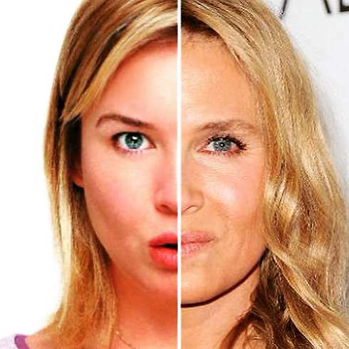 Поклонники Рене Зеллвегер уже провели сравнительный анализ у себя на фан-страничке