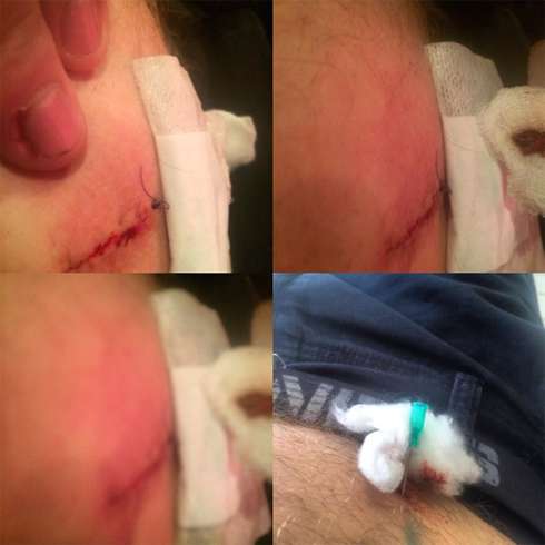 Иллюзионист перенес операцию после неудачного фокуса Иллюзионист перенес операцию после неудачного фокуса