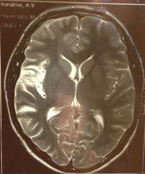 Это фото артист опубликовал у себя в микроблоге - как напоминание о том, насколько хрупок человек Это фото артист опубликовал у себя в микроблоге - как напоминание о том, насколько хрупок человек