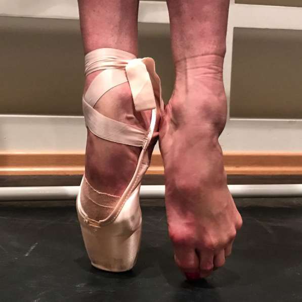 Ноги балерины после репетиции