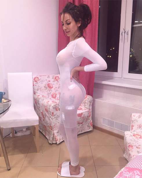 Так выглядит попа Грачевской после операции