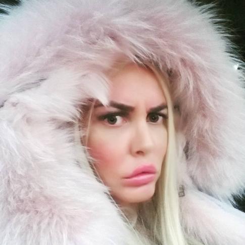 Машу Малиновскую раскритиковали за новую пластическую операцию