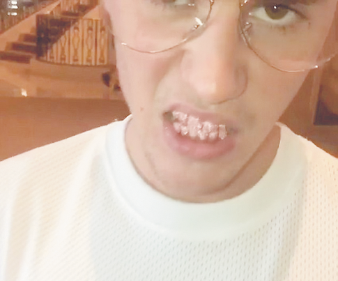 Зачем звезды носят брекеты с украшениями