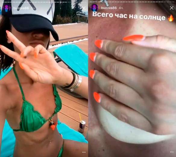 Бузова показала крымский загар