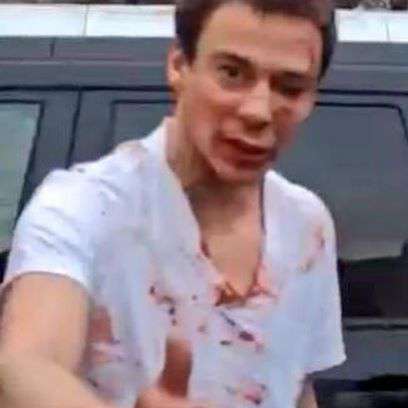 Последствия драки оказались сильными Последствия драки оказались сильными