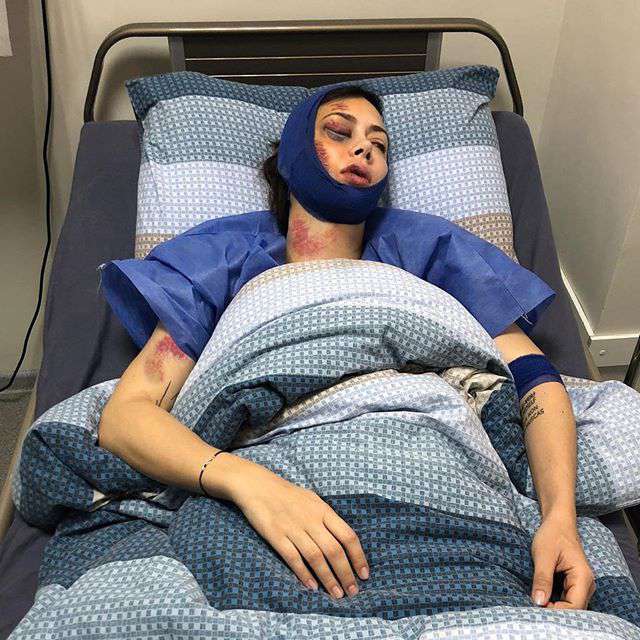 Актриса напугала поклонников