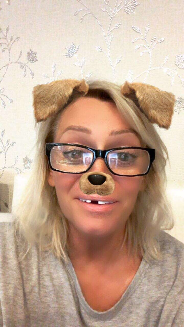 Наталия с юмором отнеслась с отсутствию зуба