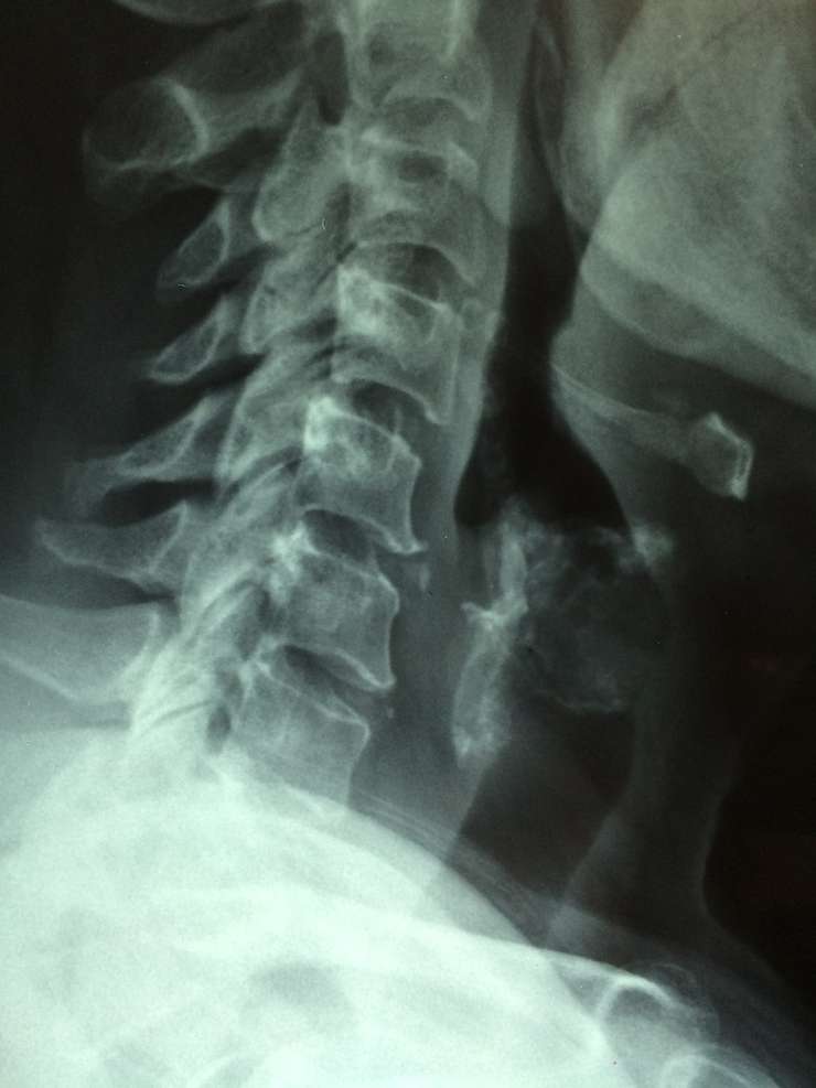 Раковые клетки делятся быстро