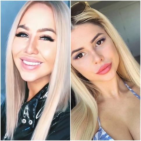 Звезды «Дома−2» сделали себе «губы дьявола»