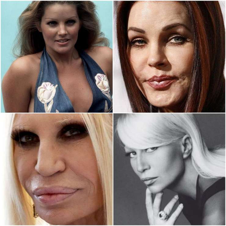 Вербицкая высказалась против пластических операций