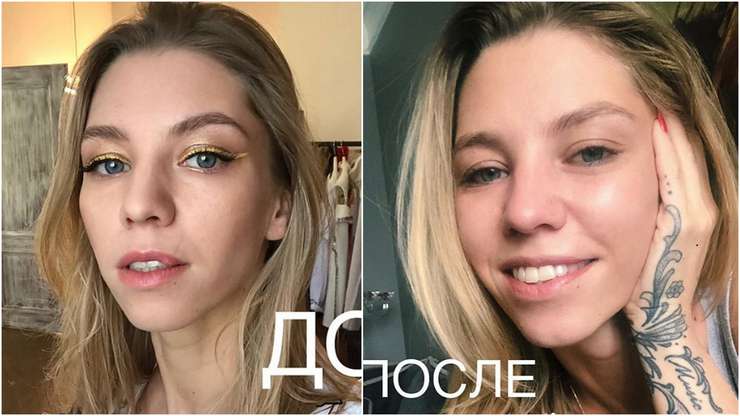 Собака укусила дочь Салтыковой за лицо