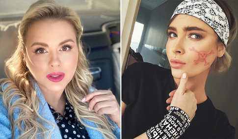 «Горячая пятерка»: самые красивые губы российских звезд