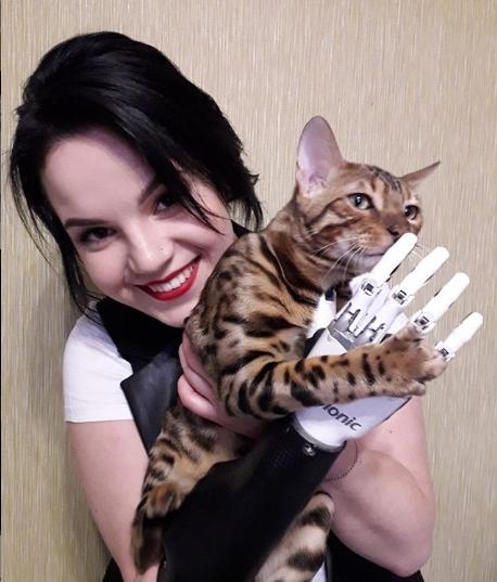 Оставшаяся без рук Маргарита Грачева вступилась за Тодоренко