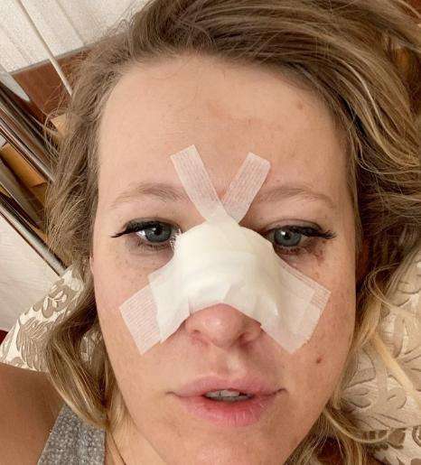 Собчак опубликовала кадры из больницы и рассказала о сломанном носе и сотрясении мозга