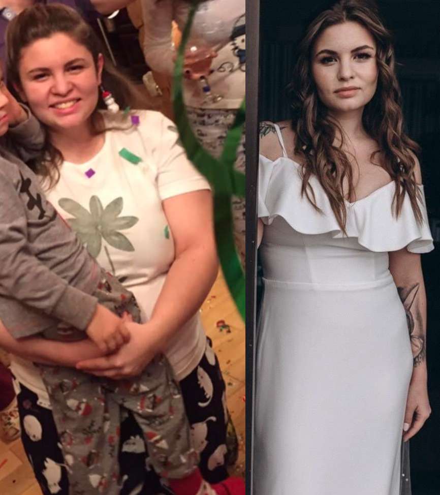 Шуня до и после