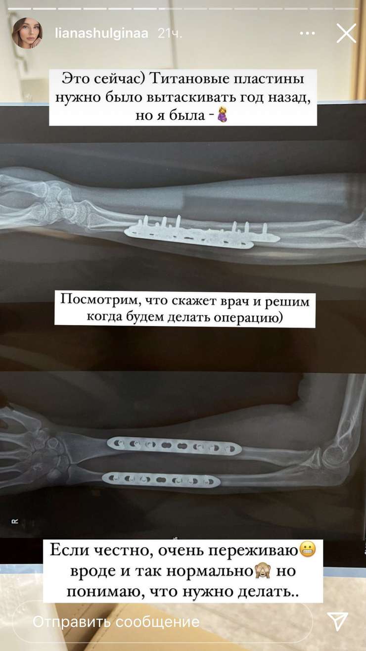 Из-за беременности девушке пришлось отложить операцию