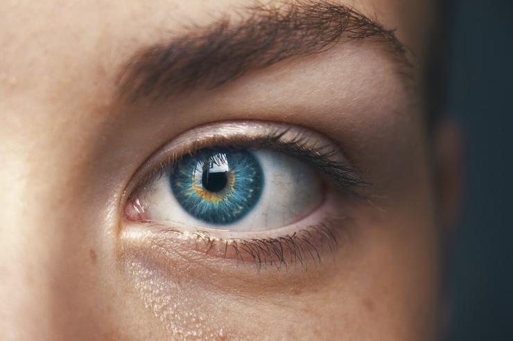 разные по цвету глаза часто являются причиной врожденной аномалии