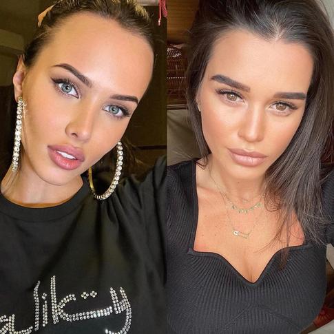 «Жир — это лишнее»: российские звезды, осудившие бодипозитивщиц