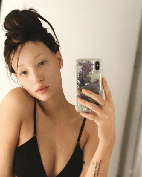 Не формат: модели, которым в карьере не помешали особенности внешности