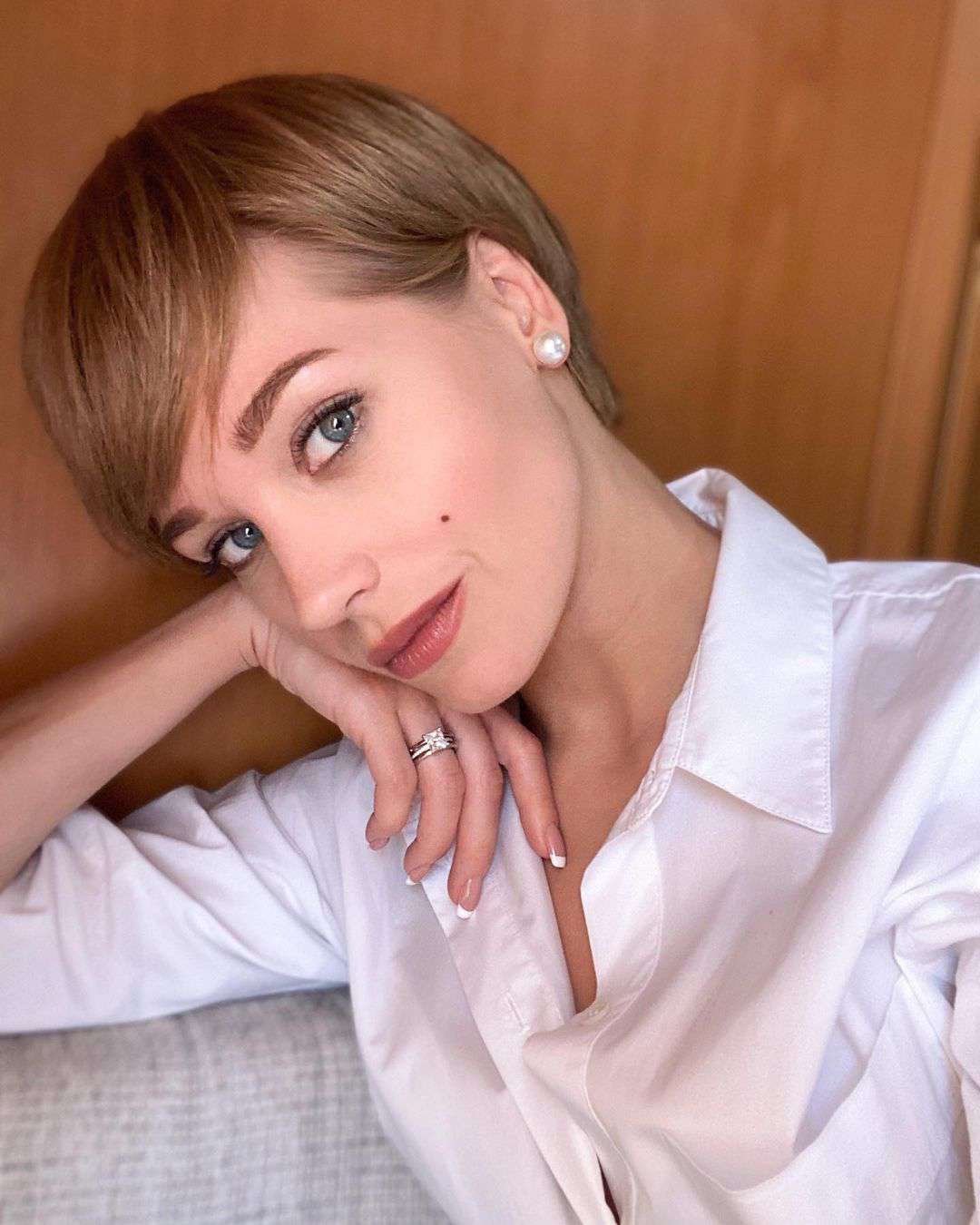 Звезда уверяет, что ее повреждения не требуют операции