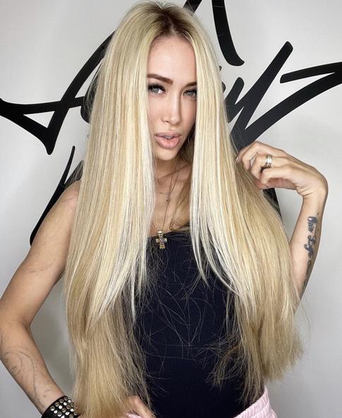 Алена Ашмарина заявила, что ее дочери нужна пересадка кожи