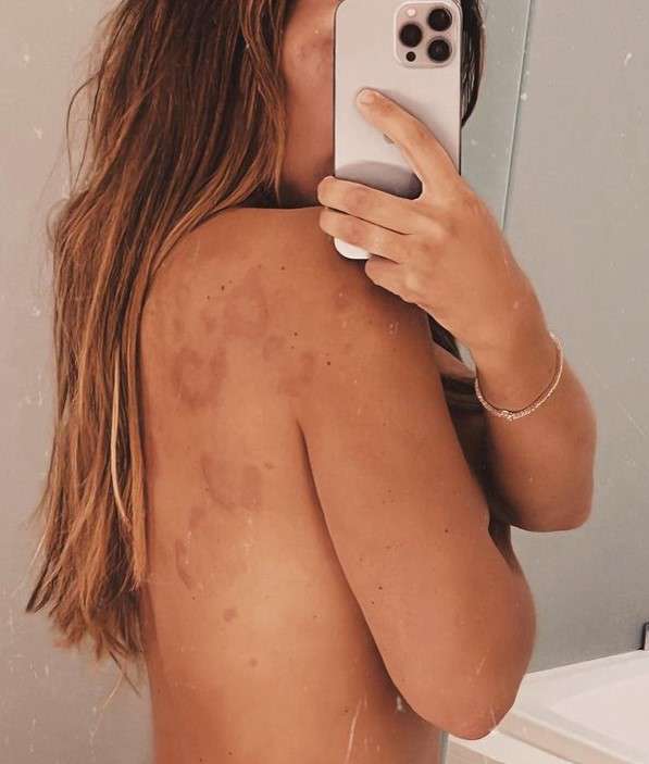 Певица намерена продолжать бороться с недугом