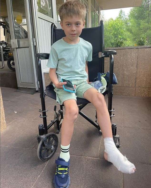 Артемий получил сломал на ноге мизинец