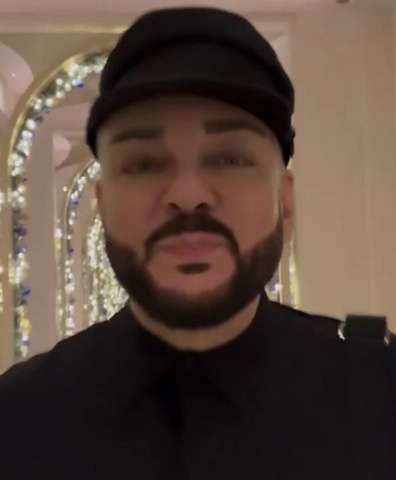 Певец показал свое изменившееся лицо Певец показал свое изменившееся лицо