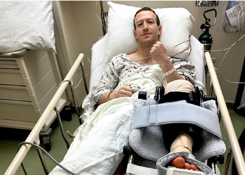 Марка Цукерберга экстренно прооперировали