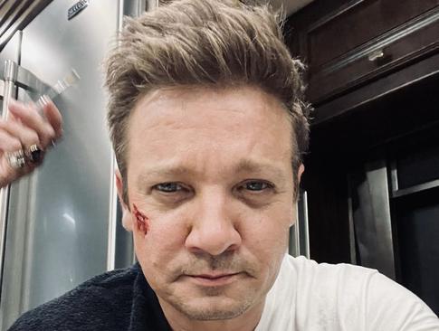 Актер «Мстителей» Джереми Реннер поделился фото с места аварии, при которой он сломал более 30 костей