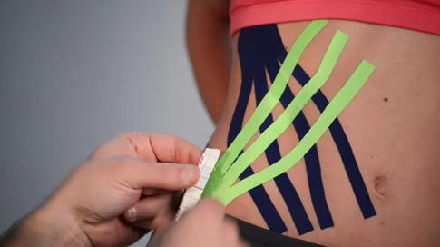 Польза или опасность: работает ли тейпирование от морщин и отеков