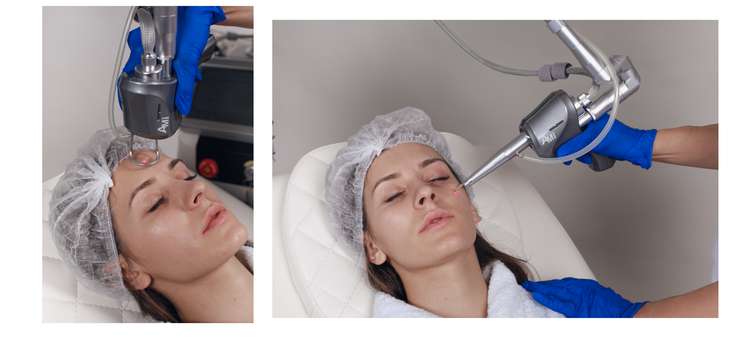 Dermaxel - аппарат известного корейского бренда, существующий на рынке с 1998 года, он популярен более чем в 50 странах. У нас «Омоложение Dermaxel» делают, например, в клинике экспертного класса сети RE:new в районе Шелепихи