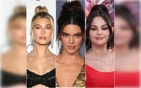 Бибер, Дженнер и другие звезды, которые всю жизнь страдают от акне