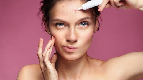 Семь привычек по уходу за кожей, которые помогут избавиться от акне на лице и теле