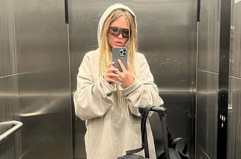 Рита Дакота пожаловалась на проблемы с кожей: «Это просто ахтунг как меня обсыпало»