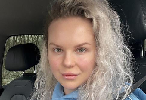 Экс-солистка «Ленинграда» Алиса Вокс рассказала о своем редком заболевании