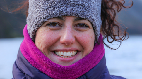 Сухость кожи зимой: как с этим бороться